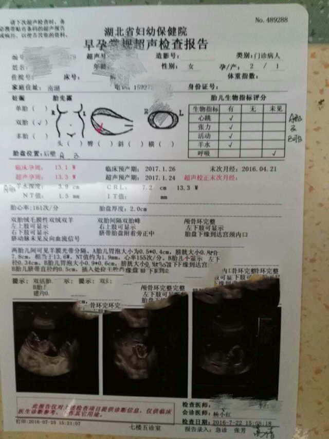 ���ݴ���